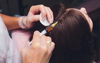 PDO Threading For Hair Growth Treatment in Ahmedabad