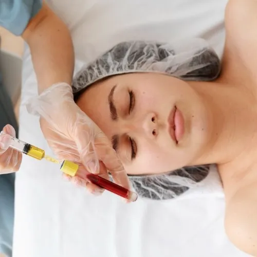 PRP Hair Treatment
