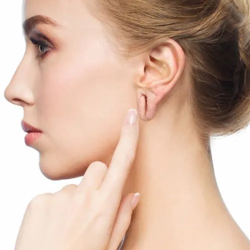 Ear Lobe Correction
