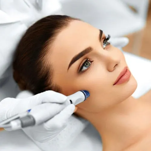Vampire Facelift Treatment