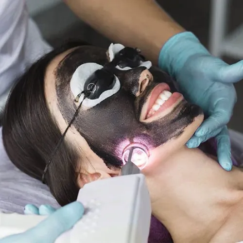 Laser Black-Out Facial