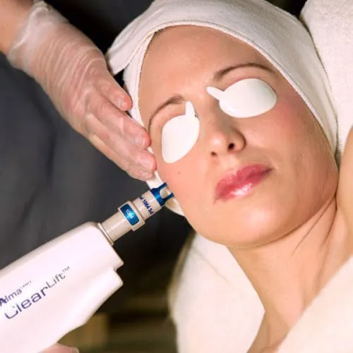 Laser Skin Rejuvenation
