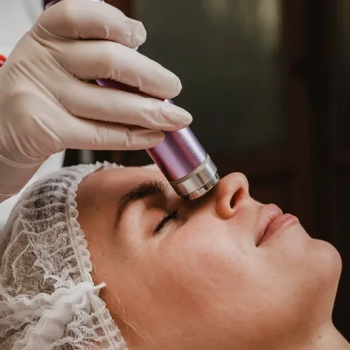 Microneedling Therapy